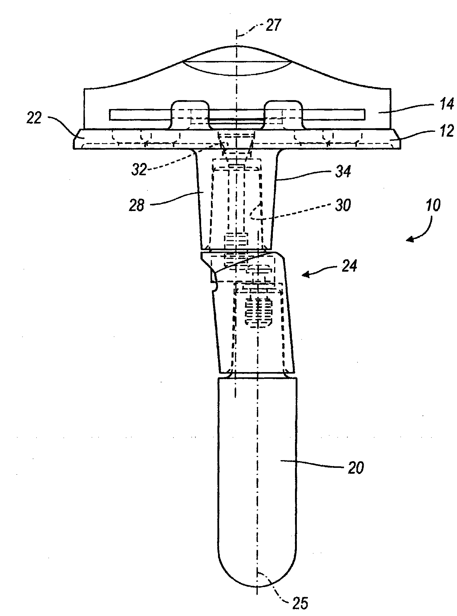Knee joint prosthesis system and method for implantation