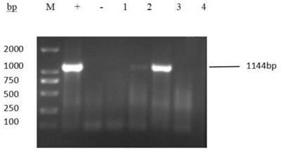 Method for infecting porcine small intestinal mucosa epithelial cell line with porcine epidemic diarrhea virus