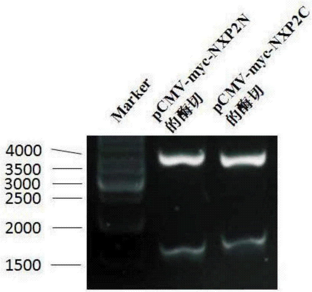 Immunoblotting assay method of myositis specific autoantibody NXP2 antibody and application