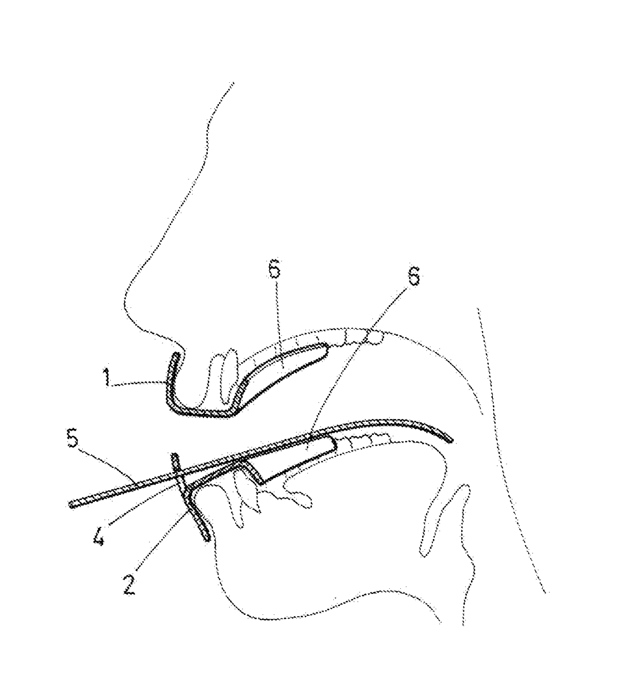 Mouth protector device with tongue depressor