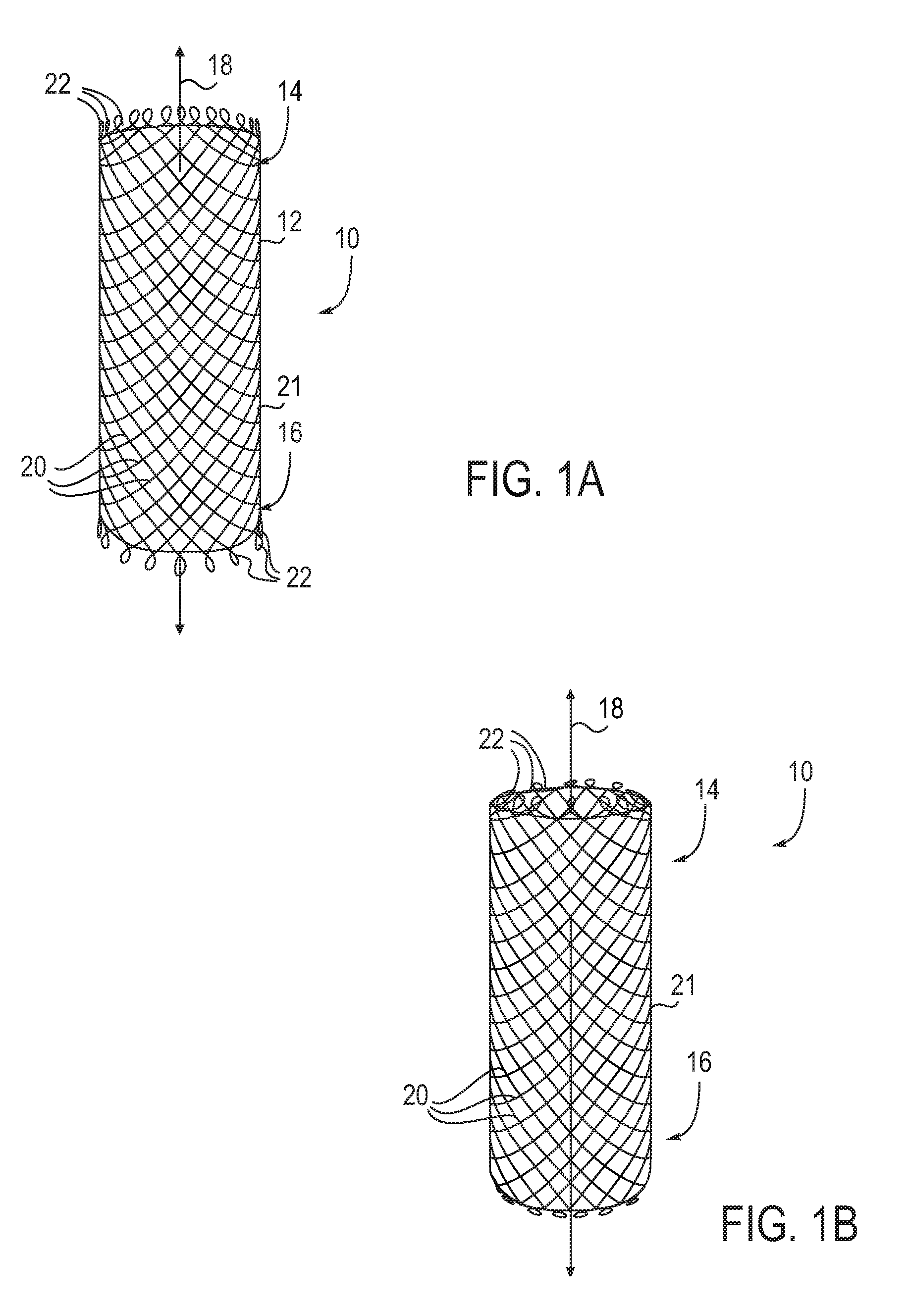 Rail stent and methods of use