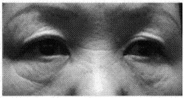 Hydrogel capable of eliminating eye bags and wrinkles and preparation method thereof