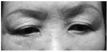 Hydrogel capable of eliminating eye bags and wrinkles and preparation method thereof