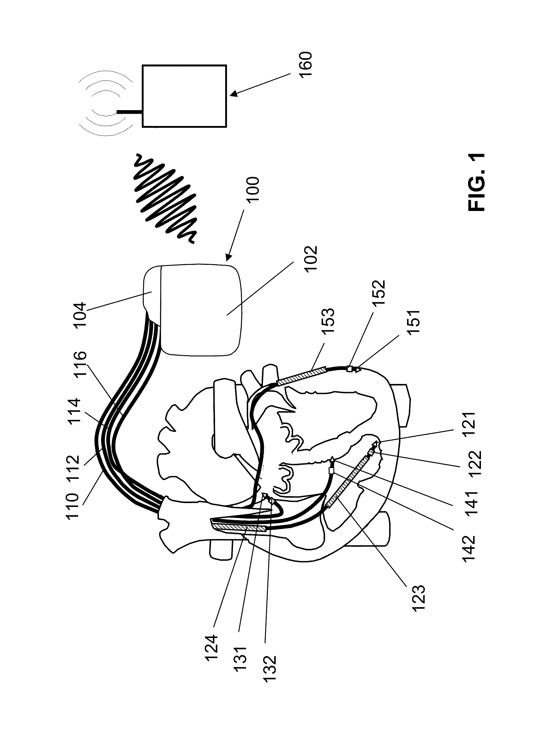 Cardiac stimulator for delivery of cardiac contractility modulation therapy