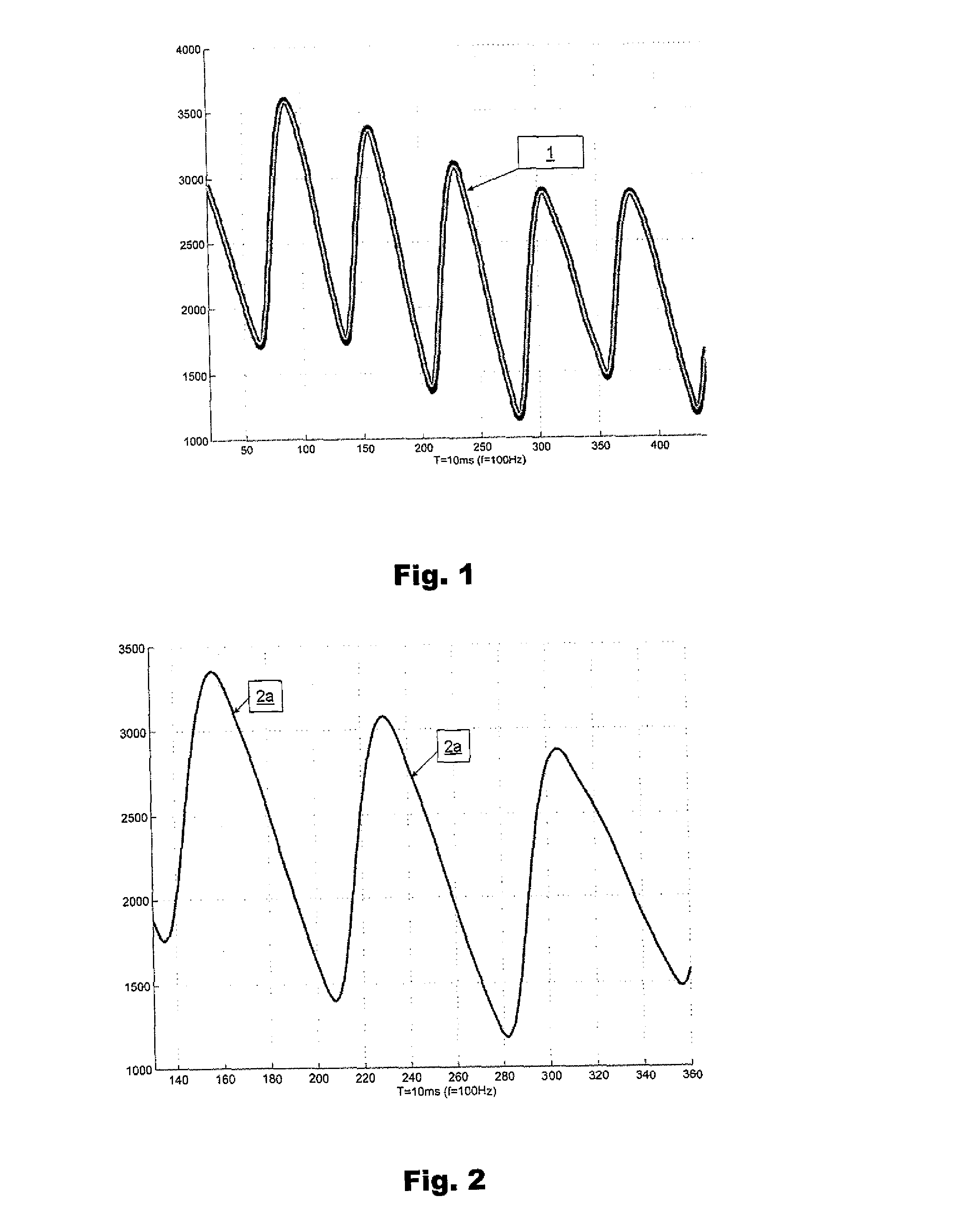 A method of determining systolic and diastolic blood pressure and the unit for this method