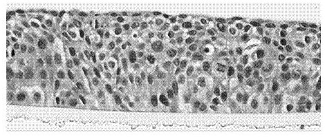 A serum-containing oral mucosal epithelial cell culture solution