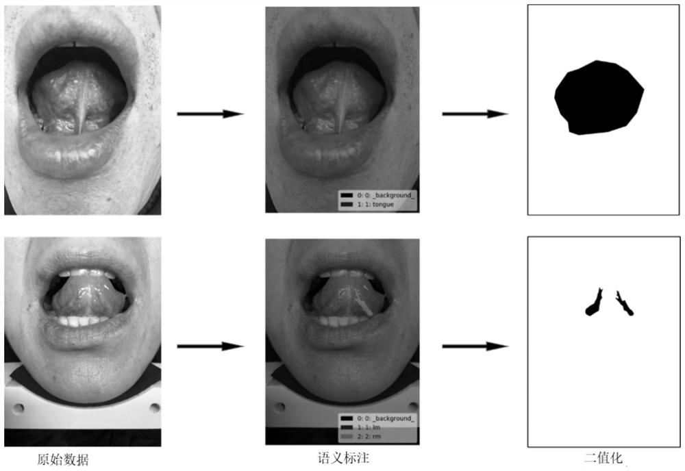 Deep learning-based traditional Chinese medicine sublingual vein semantic segmentation extraction method and system