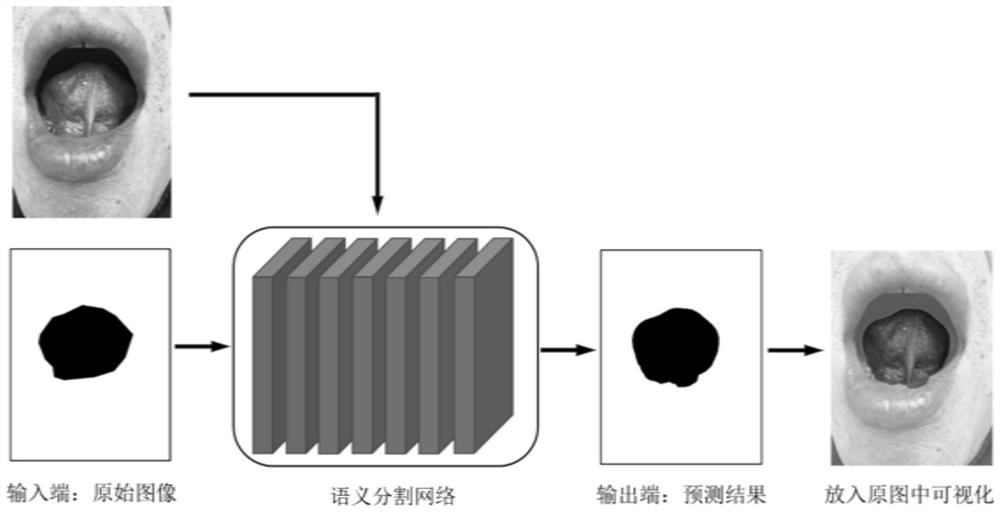 Deep learning-based traditional Chinese medicine sublingual vein semantic segmentation extraction method and system