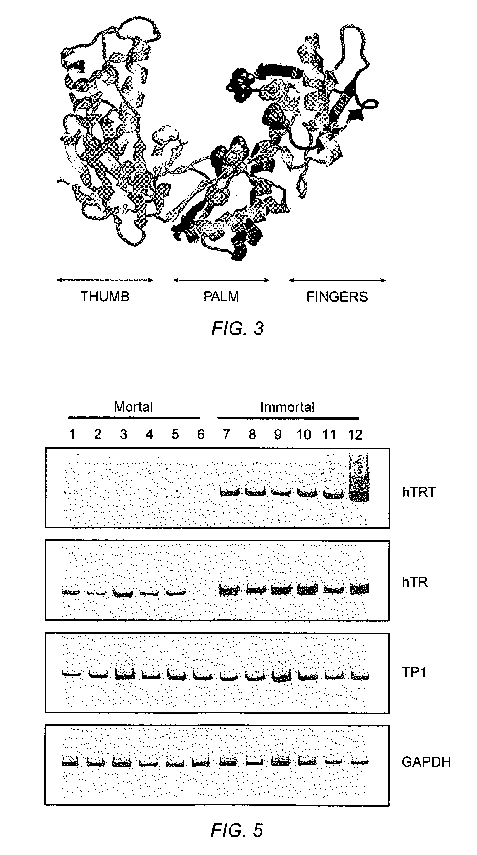 Methods for detection of human telomerase reverse transcriptive protein