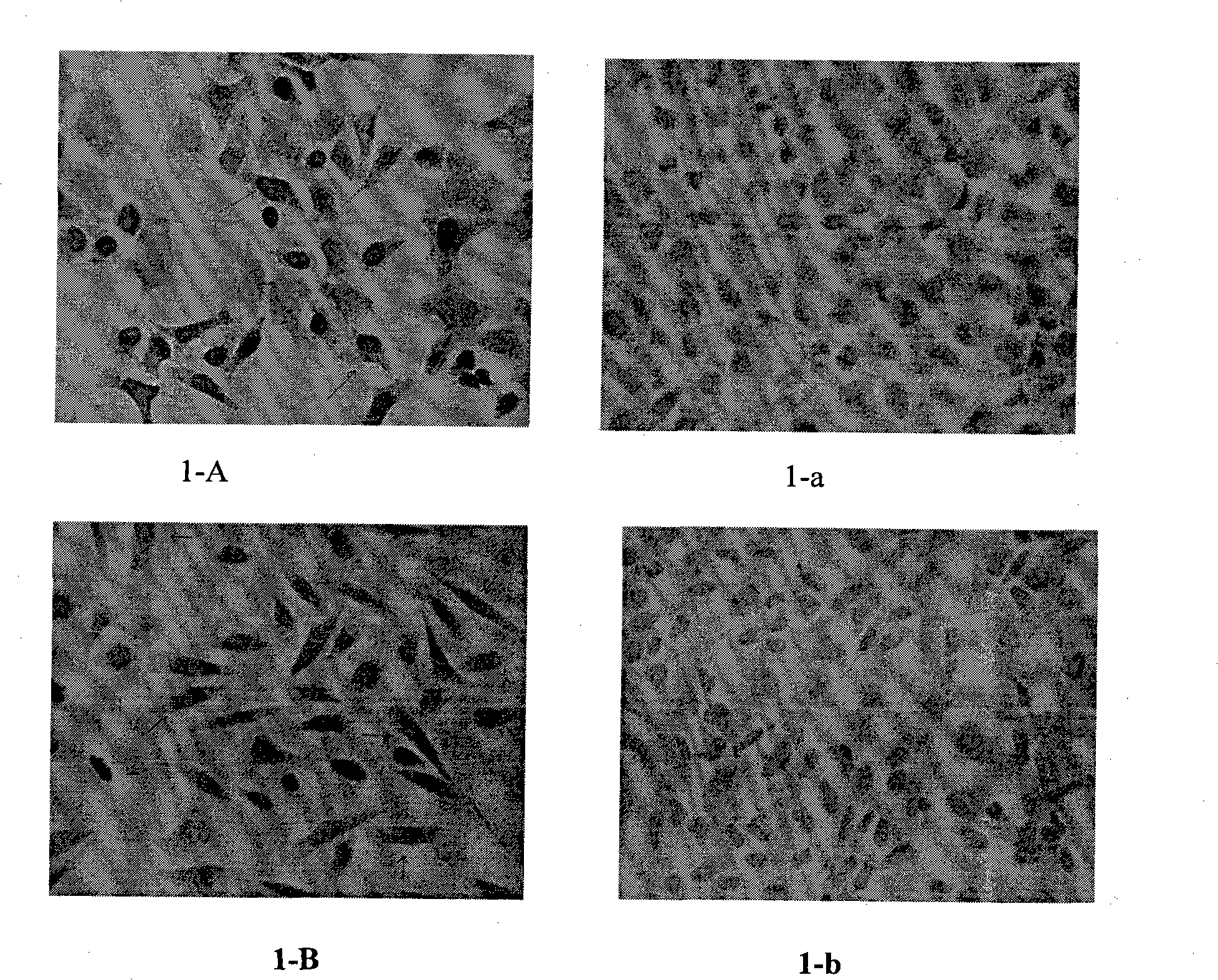Human papilloma virus (HPV) capsid protein L1 polypeptide and preparation and application thereof