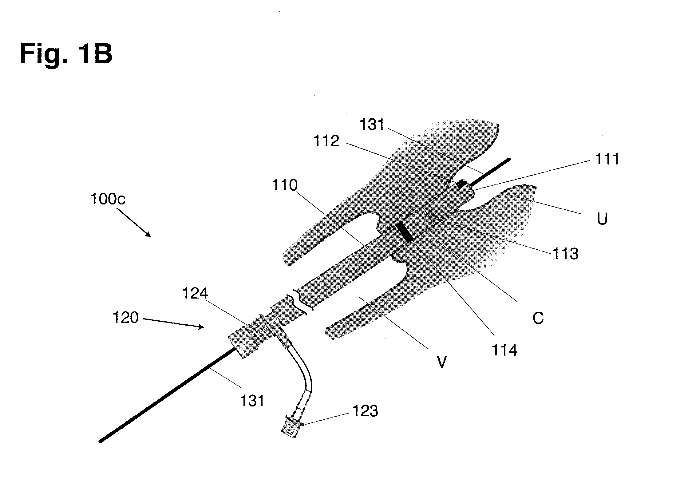 Systems for performing gynecological procedures with simultaneous tissue cutting and removal