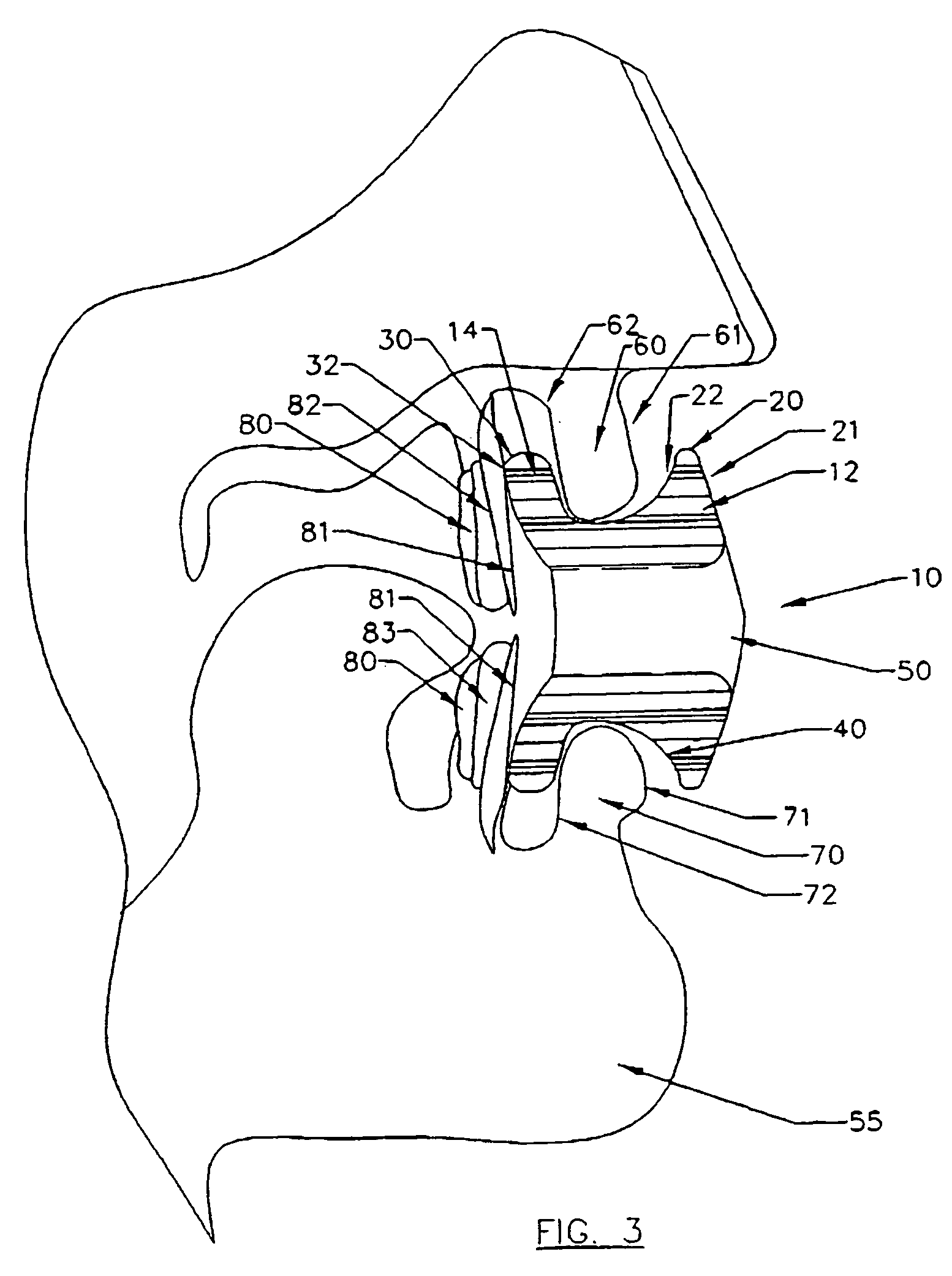 Apparatus for enhancing exercises and methods of using same