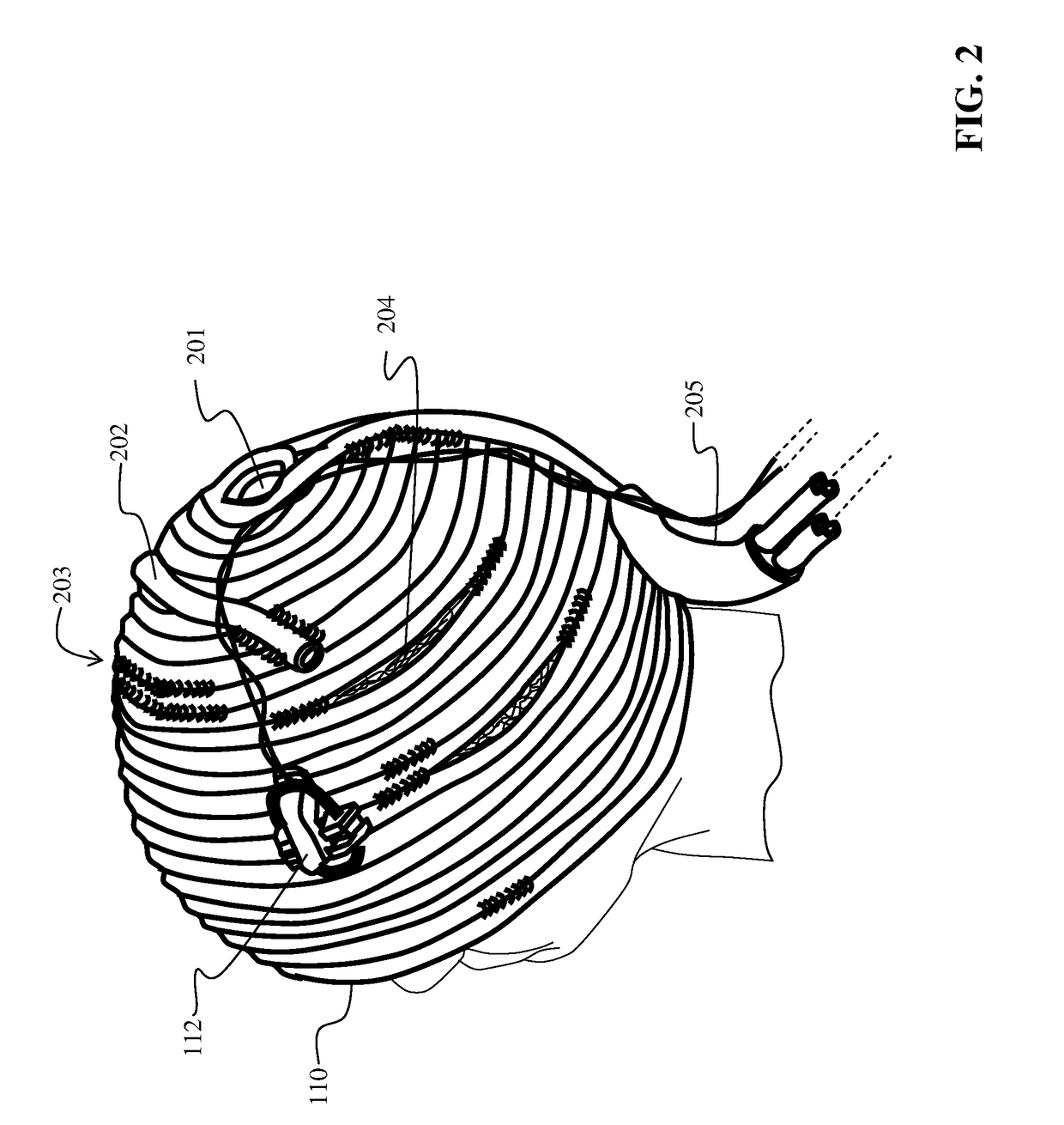 Method and Apparatus of a Self-Managed Portable Hypothermia System