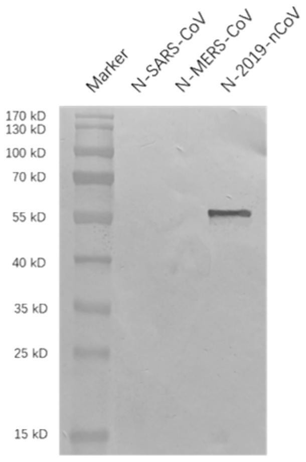 2019-nCoV N protein linear epitope peptide, monoclonal antibody and application
