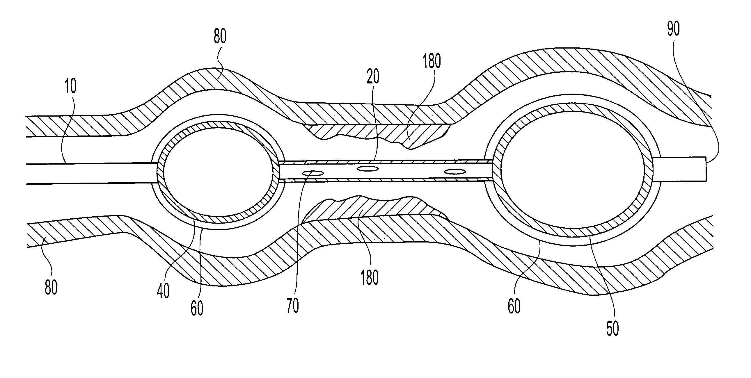 Multi-balloon catheter with hydrogel coating