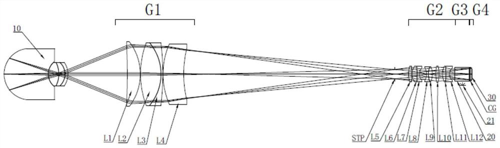 Fundus imaging system