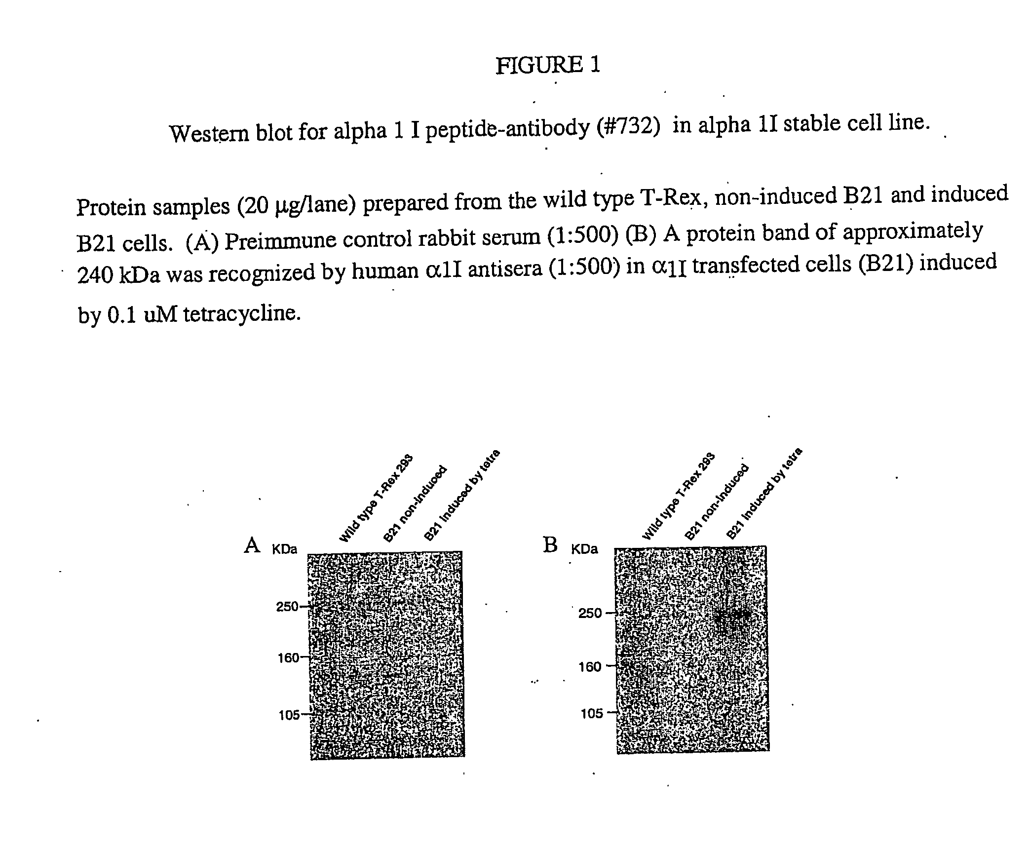 Nucleic Acid Molecules Encoding Novel Human Low-Voltage Activated Calcium Channel Proteins, Designed-Alpha 1I-1 and Alpha 1I-2, Encoded Proteins and Methods of Use Thereof