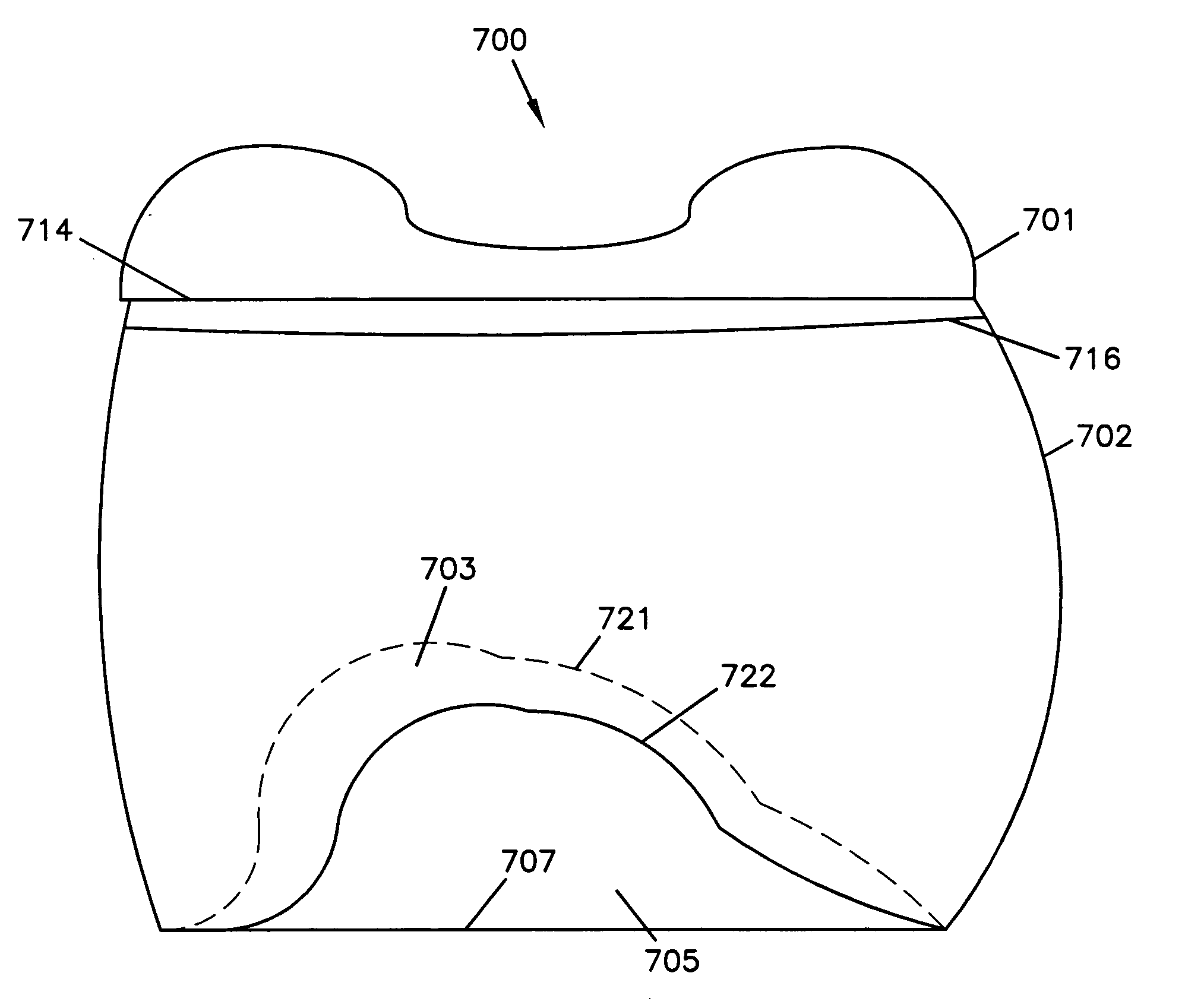 Multi-component dental appliances and a method for constructing the same