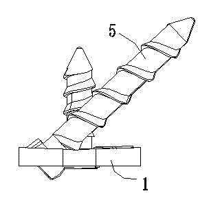 Lower cervical spine anterior pedicle screw matching, fixing and retaining device