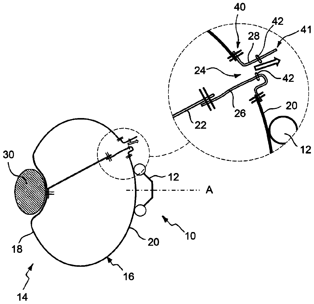 Airbag for vehicle occupant restraint system