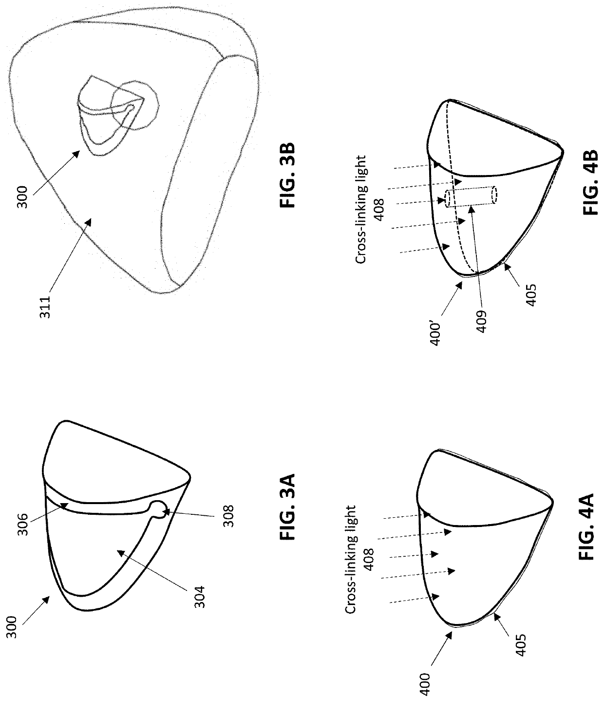 Dental attachment placement structure