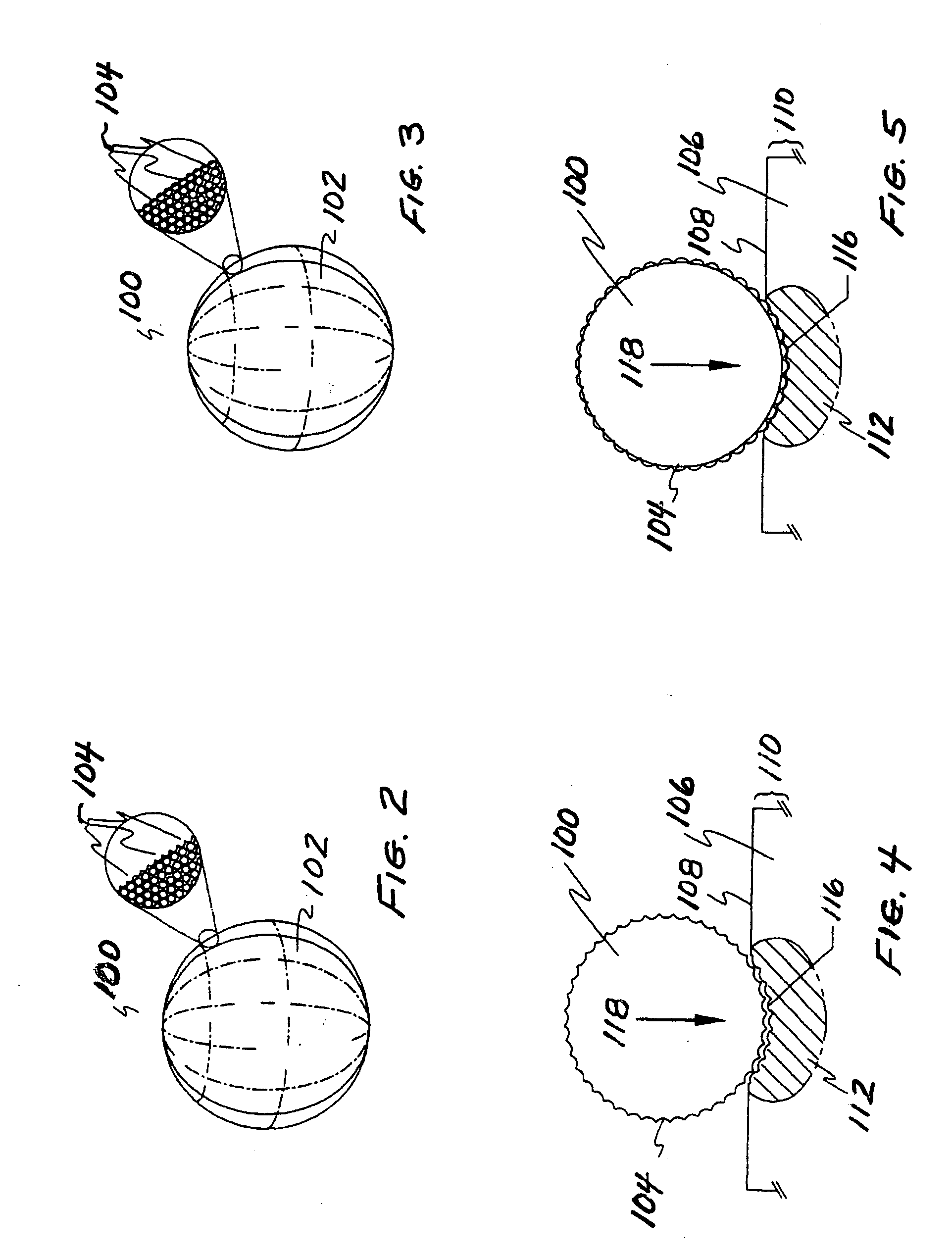 Method and apparatus for improving the distribution of compressive stress