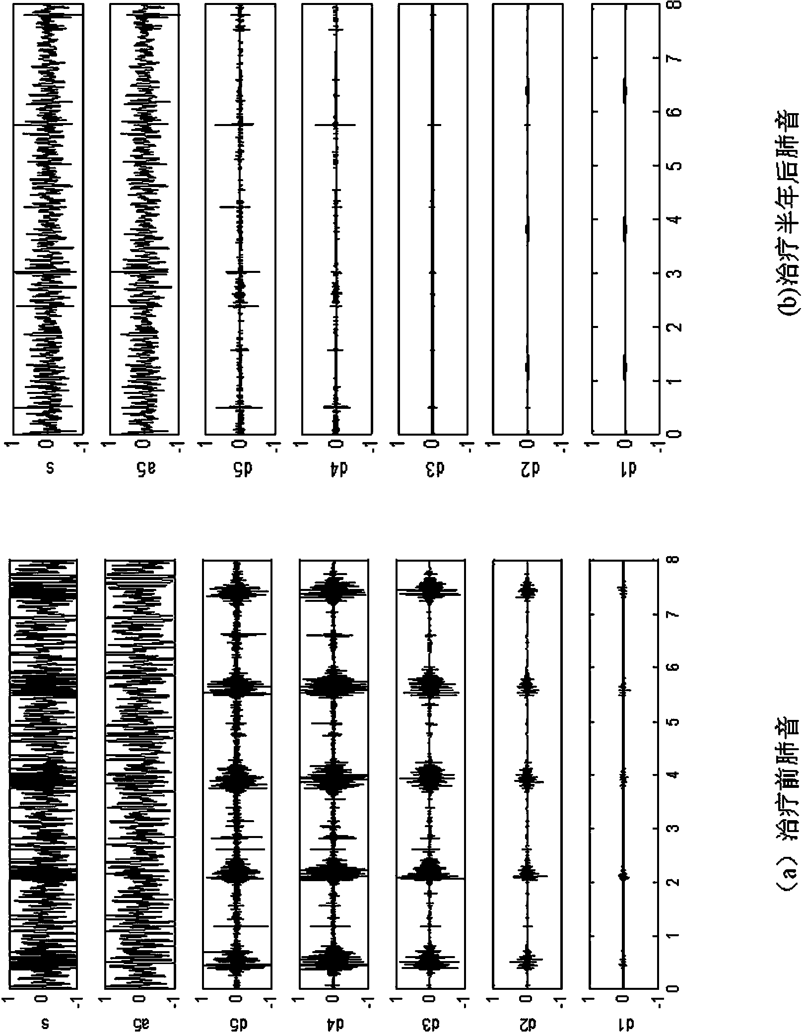 Digitalized detecting analysis method for pulmonary interstitial fibrosis based on lung sound