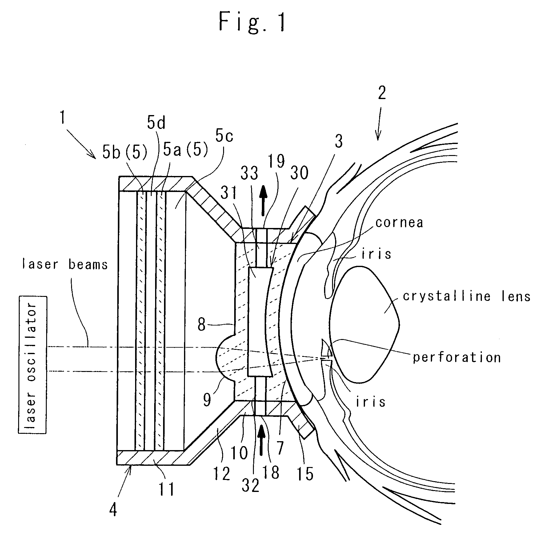 Ophthalmic laser treatment device