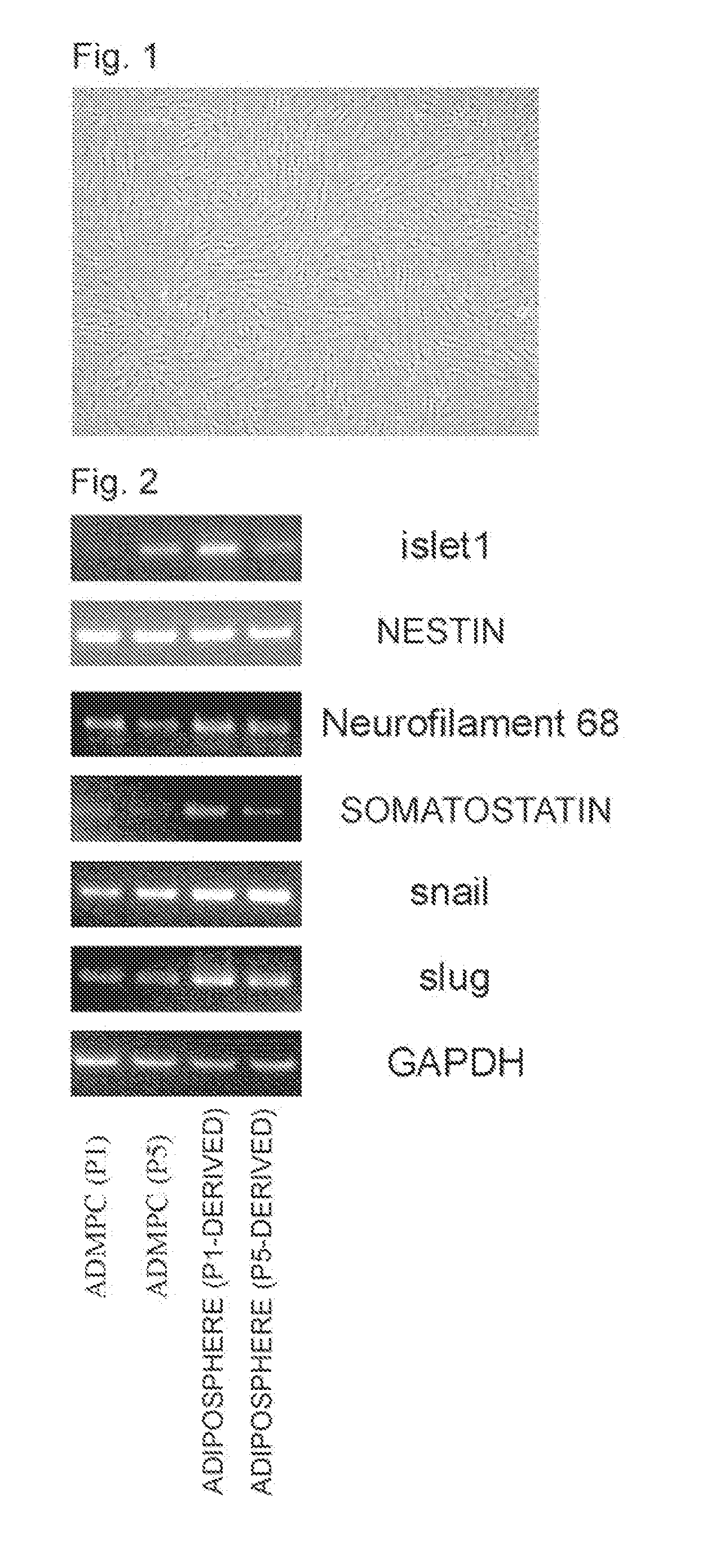 Multipotent progenitor cell derived from adipose tissue