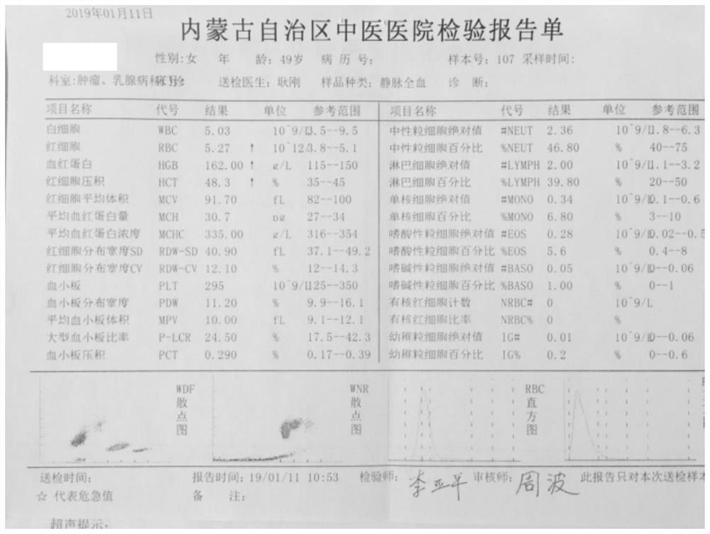 A traditional Chinese medicine composition for treating female mammary gland hyperplasia and preparation method thereof