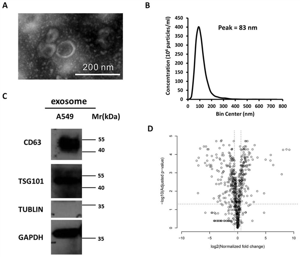 Molecular markers related to the prognosis of non-small cell lung cancer and their application