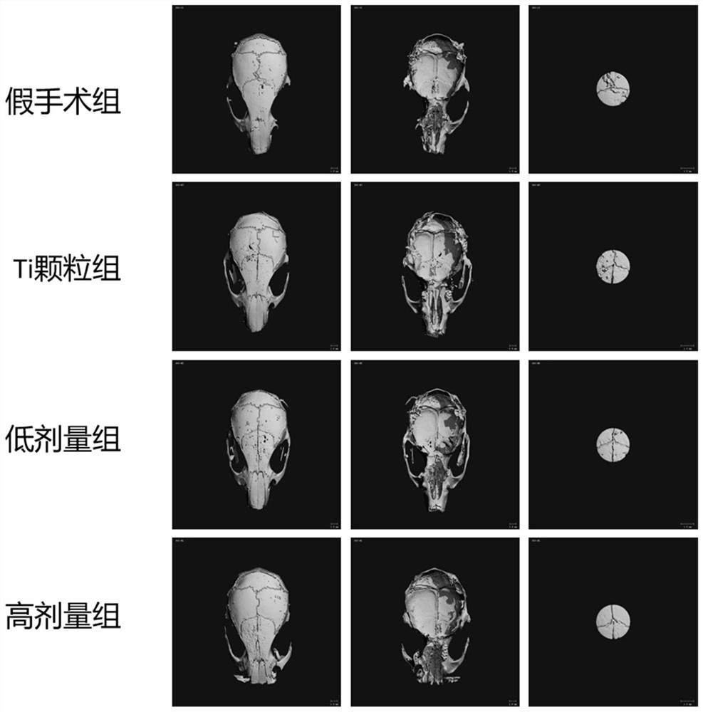 Application of curculigoside in preparation of medicines for treating periprosthetic osteolysis