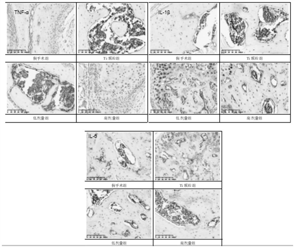 Application of curculigoside in preparation of medicines for treating periprosthetic osteolysis