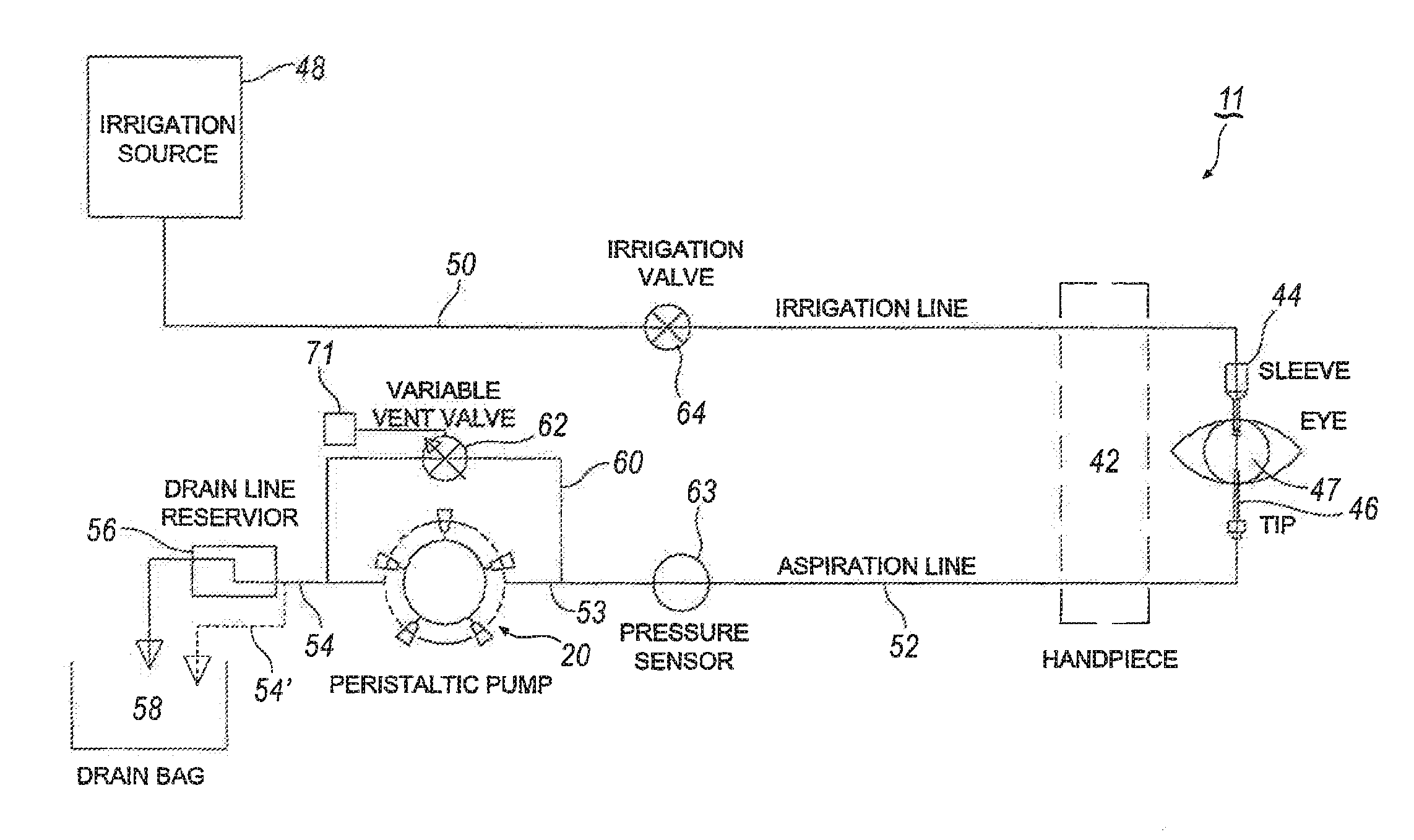 Selectively Moveable Valve Elements for Aspiration and Irrigation Circuits