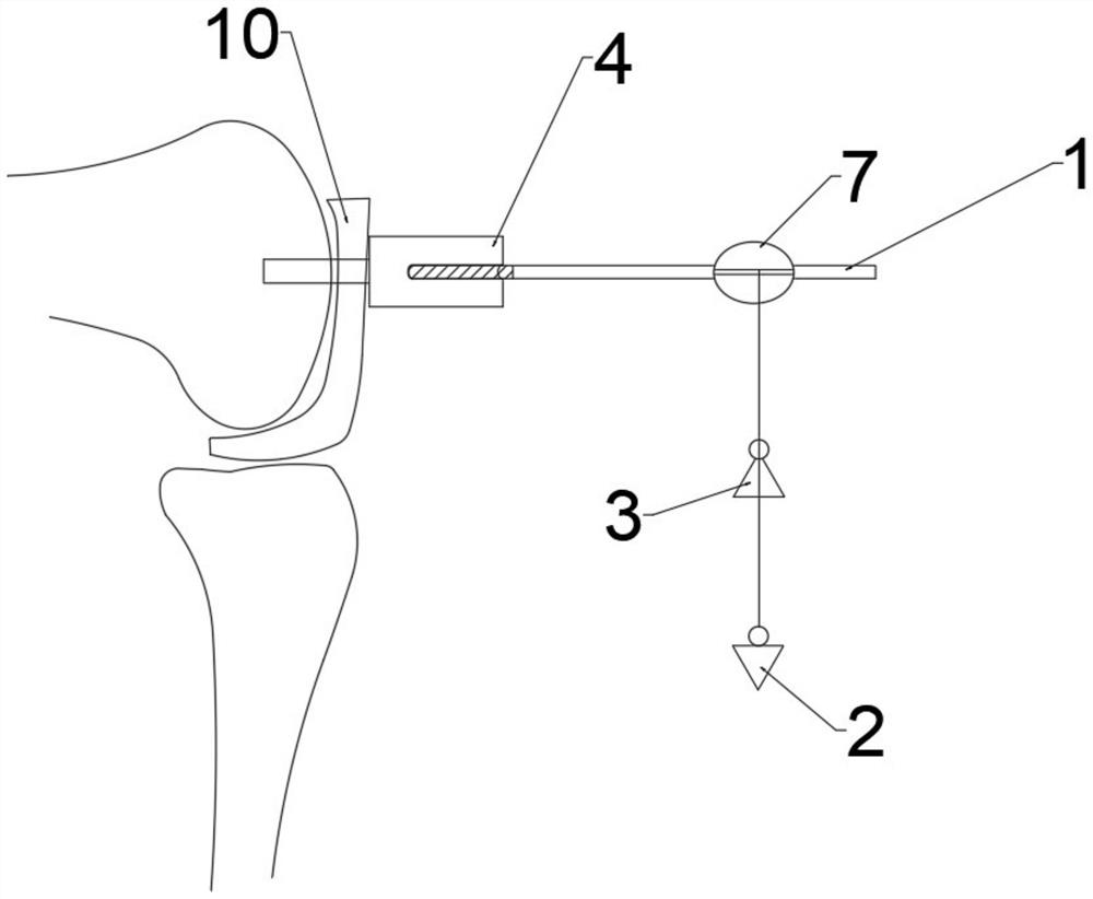 Device for unicondylar arthroplasty femoral condyle positioning and tibia osteotomy accuracy judgment