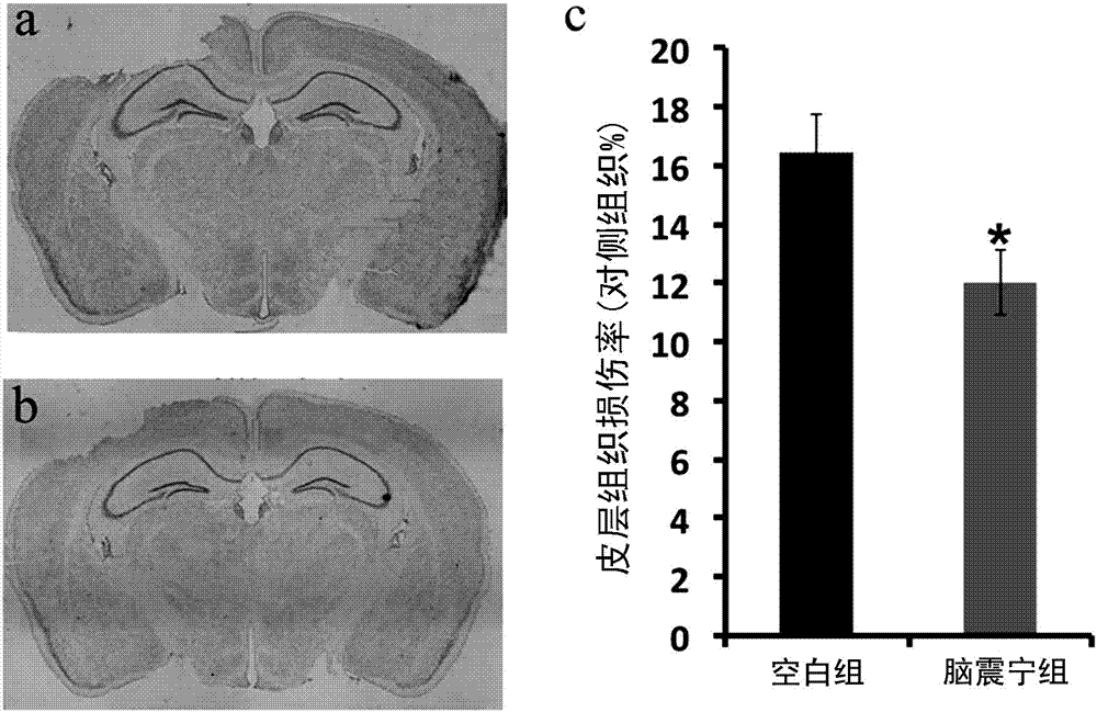 New pharmaceutical use of Naozhenning preparation