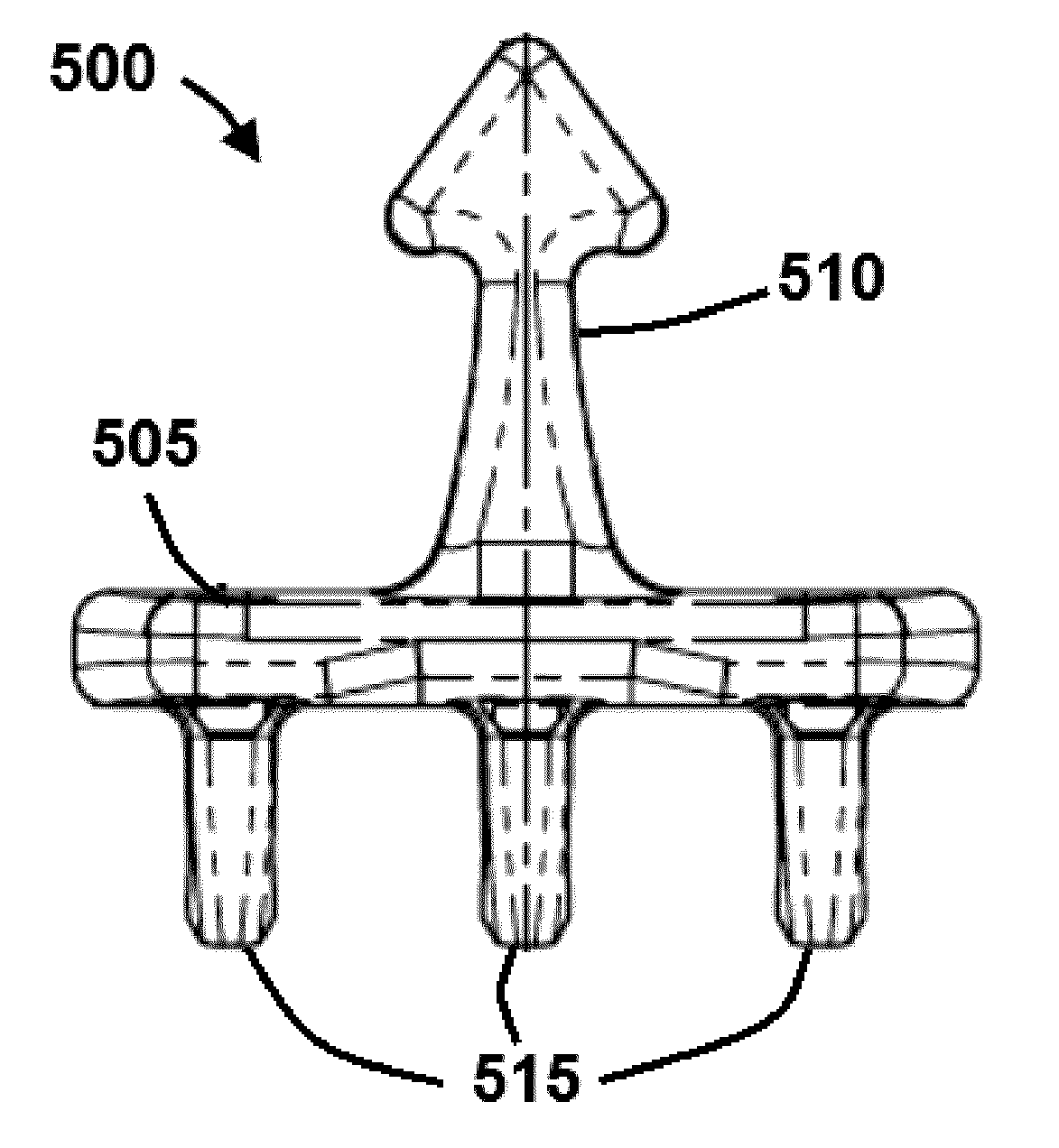 Methods and Systems for Medializing a Turbinate