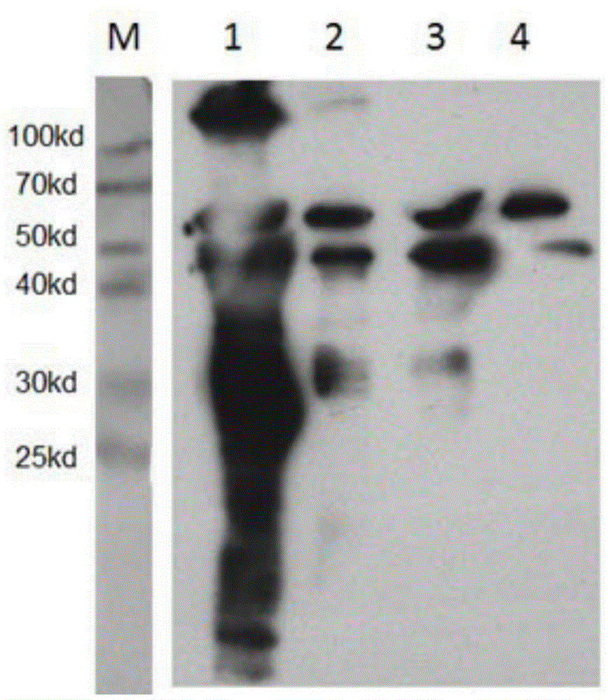 Apolygus lucorum soluble trehalase (AlTre-1) monoclonal antibody as well as preparation method and application of thereof