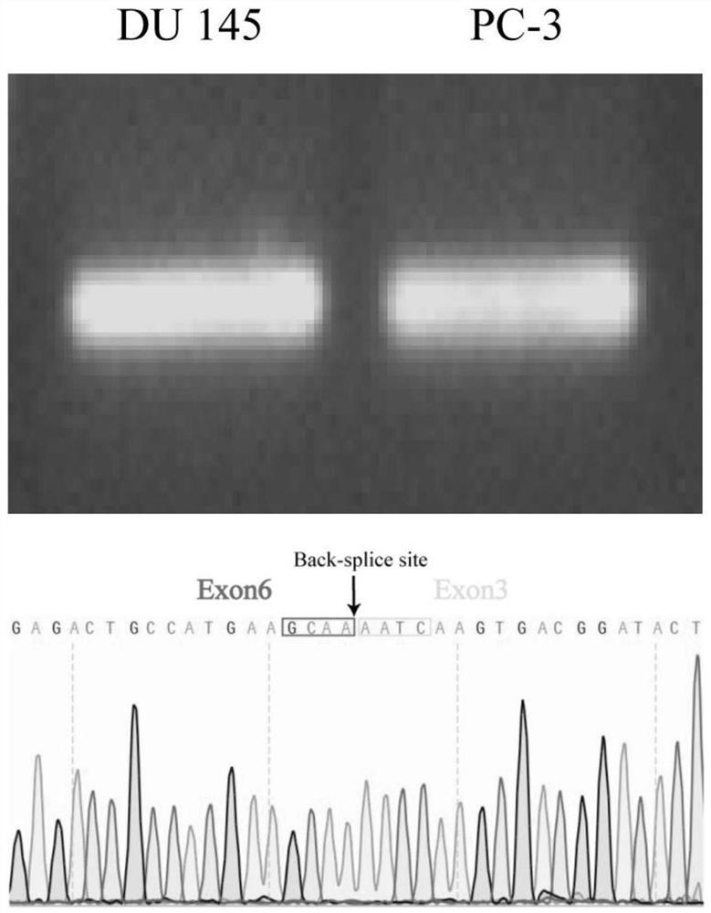 Application of circular RNA-circEXOC6B in inhibiting metastasis of prostate cancer