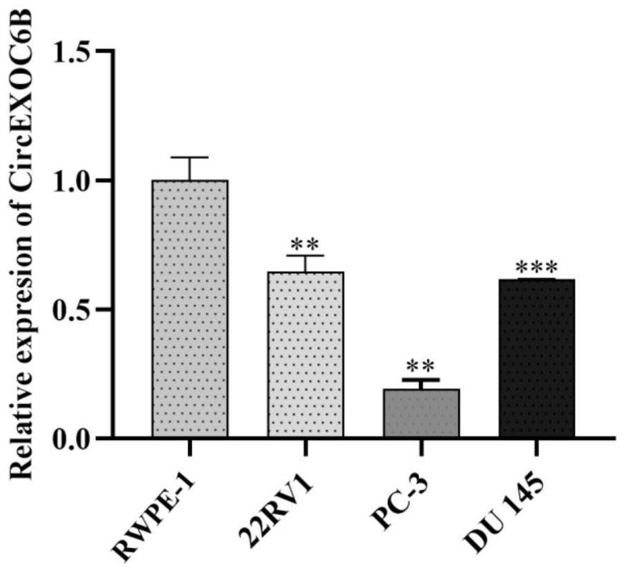 Application of circular RNA-circEXOC6B in inhibiting metastasis of prostate cancer