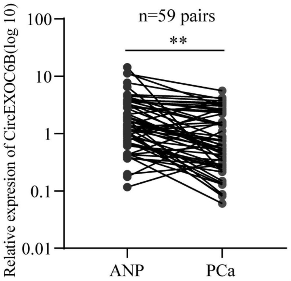 Application of circular RNA-circEXOC6B in inhibiting metastasis of prostate cancer