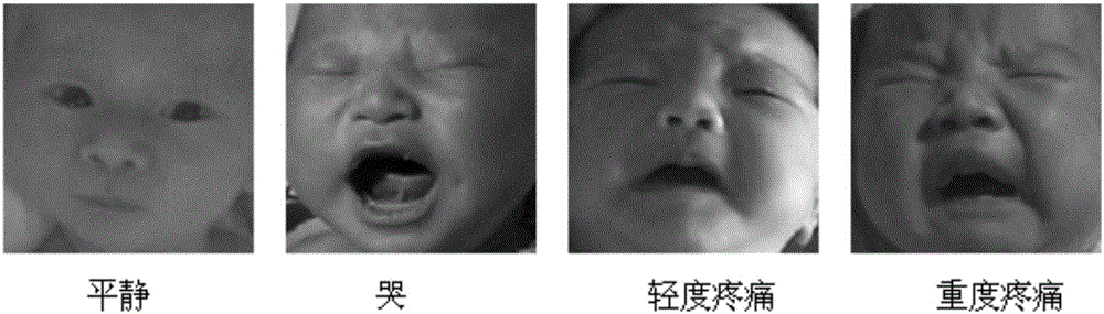Neonatal pain expression classification method based on CNN (convolutional neural network)