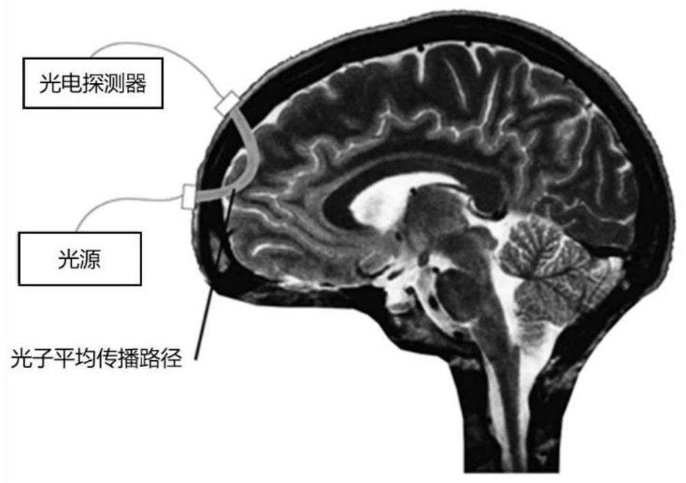 Worn type fNIRS brain imaging system