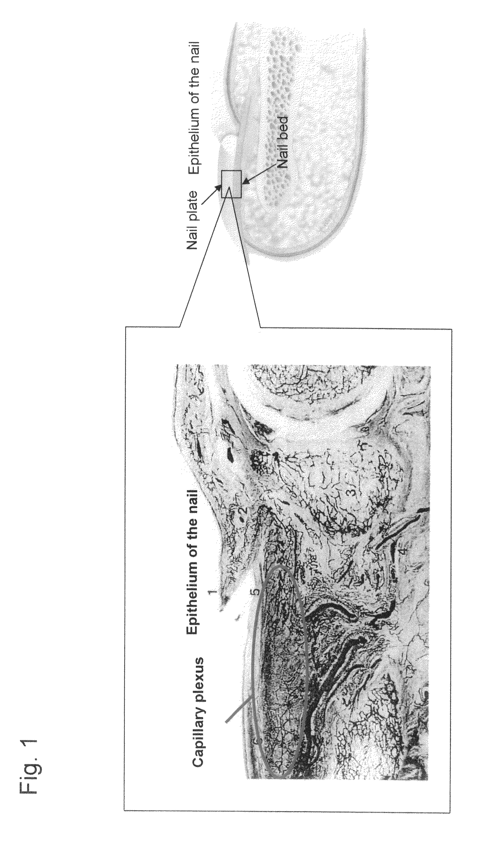 Noninvasive measuring device for substance in blood via nail and a nail evaporation device