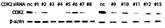 Application of cdk2 gene in preparation of medicine for inducing differentiation therapy of leukemia