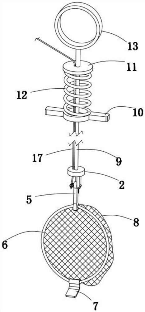 Gallstone extractor