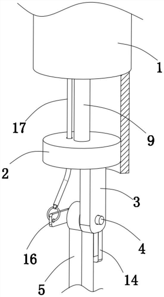 Gallstone extractor