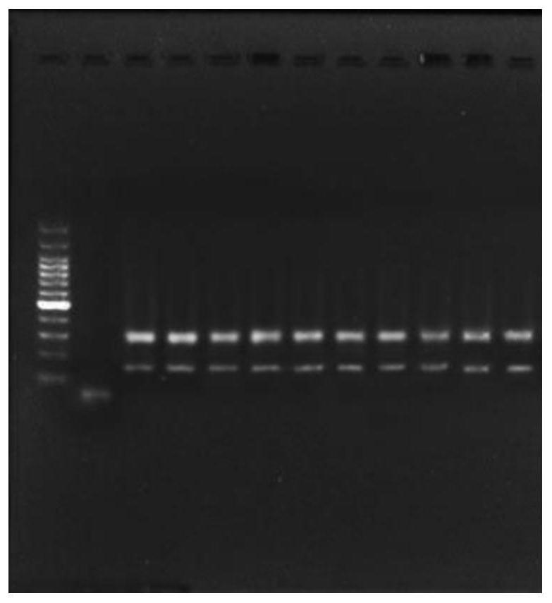 PCR-specific primers, kits and methods of use for detection of thyroid cancer metastasis-related genes