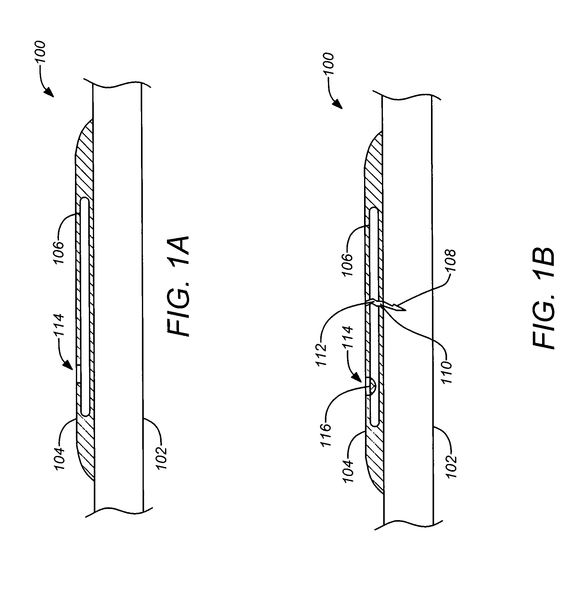 Fracture detecting structural health sensor