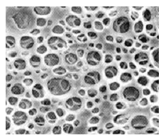 Method for preparing high-intensity three-dimensional chitosan porous bracket